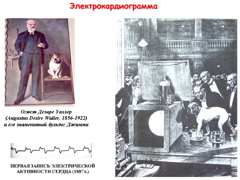 Электрокардиограмма Огюст Дезире Уоллер (Augustus Desire Waller, 1856-1922) и его знаменитый бульдог Электрокардиограмма Огюст Дезире Уоллер (Augustus Desire Waller, 1856-1922) и его знаменитый бульдог